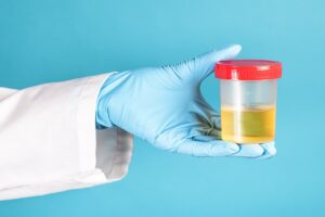 A scientist holding a urine sample